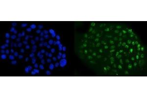 IF analysis of NFIB/NF1B2 using anti-NFIB/NF1B2 antibody (ABIN7602995). (NFIB anticorps  (Middle Region))