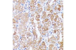 Immunohistochemistry of paraffin-embedded human stomach using SPON2 antibody (ABIN6129679, ABIN6148370, ABIN6148372 and ABIN6215647) at dilution of 1:100 (40x lens).