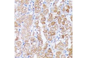Immunohistochemistry of paraffin-embedded human stomach using SPON2 antibody (ABIN6129679, ABIN6148370, ABIN6148372 and ABIN6215647) at dilution of 1:100 (40x lens). (SPON2 anticorps  (AA 27-150))