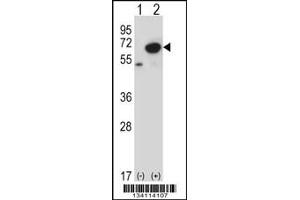 Western blot analysis of PNKP using rabbit polyclonal PNKP Antibody using 293 cell lysates (2 ug/lane) either nontransfected (Lane 1) or transiently transfected (Lane 2) with the PNKP gene. (PNKP anticorps  (N-Term))