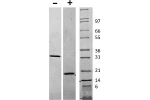 SDS-PAGE of Human Macrophage Colony Stimulating Factor Recombinant Protein SDS-PAGE of Human Macrophage Colony Stimulating Factor Recombinant Protein.