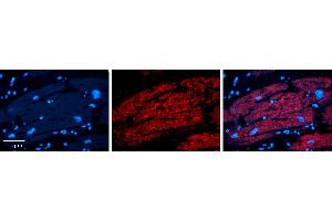 Rabbit Anti-IRF1 Antibody Catalog Number: ARP31296_P050 Formalin Fixed Paraffin Embedded Tissue: Human heart Tissue Observed Staining: Cytoplasmic Primary Antibody Concentration: 1:100 Other Working Concentrations: 1:600 Secondary Antibody: Donkey anti-Rabbit-Cy3 Secondary Antibody Concentration: 1:200 Magnification: 20X Exposure Time: 0. (IRF1 anticorps  (N-Term))