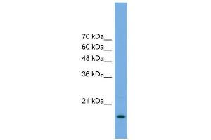 WB Suggested Anti-POP5 Antibody Titration: 0. (POP5 anticorps  (Middle Region))