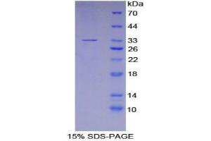 SDS-PAGE analysis of Human P2RY14 Protein. (P2RY14 Protéine)