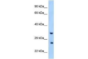WB Suggested Anti-Prrg4 Antibody Titration: 1. (PRRG4 anticorps  (N-Term))