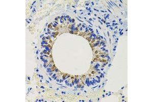 Immunohistochemistry of paraffin-embedded mouse lung using CALB2 antibody. (Calretinin anticorps  (AA 1-271))