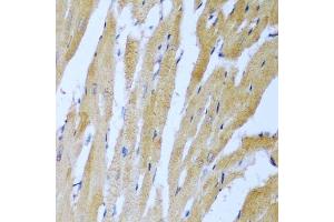 Immunohistochemistry of paraffin-embedded rat heart using IGF2BP3 antibody.