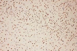 Anti-PIAS1 antibody, IHC(P) IHC(P): Rat Brain Tissue
