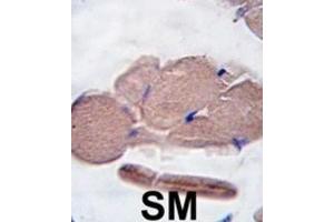 Immunohistochemistry (IHC) image for anti-Myostatin (MSTN) antibody (ABIN2916193) (MSTN anticorps)