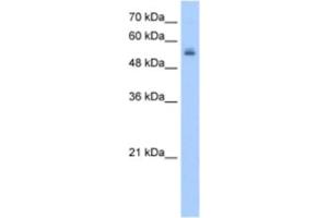 Western Blotting (WB) image for anti-UDP Glycosyltransferase 3 Family, Polypeptide A2 (UGT3A2) antibody (ABIN2463263) (UGT3A2 anticorps)