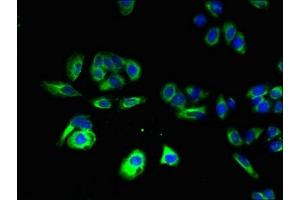 Immunofluorescent analysis of HepG2 cells using ABIN7165217 at dilution of 1:100 and Alexa Fluor 488-congugated AffiniPure Goat Anti-Rabbit IgG(H+L) (CNIH4 anticorps  (AA 78-117))