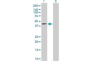 Western Blot analysis of FASN expression in transfected 293T cell line by FASN monoclonal antibody (M01), clone 3F2-1F3.