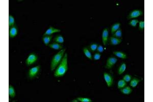 Immunofluorescent analysis of HepG2 cells using ABIN7171676 at dilution of 1:100 and Alexa Fluor 488-congugated AffiniPure Goat Anti-Rabbit IgG(H+L) (TCTN3 anticorps  (AA 348-472))