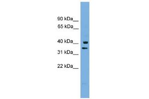 WB Suggested Anti-PNRC1 Antibody Titration: 0. (PNRC1 anticorps  (Middle Region))