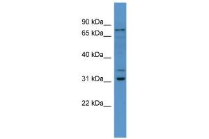 WB Suggested Anti-Fbxo34 Antibody Titration: 0. (FBXO34 anticorps  (N-Term))