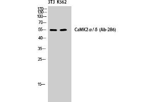 Western Blotting (WB) image for anti-CaMKIIalpha/delta (Thr286) antibody (ABIN5960662) (CaMKIIalpha/delta anticorps  (Thr286))