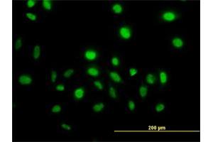 Immunofluorescence of monoclonal antibody to VAV1 on HeLa cell.
