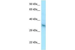 WB Suggested Anti-YIPF1 Antibody Titration: 1. (YIPF1 anticorps  (C-Term))