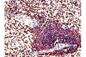 Immunohistochemistry of paraffin-embedded human spleen tissue using ABIN7148593 at dilution of 1:100 (Coronin 1a anticorps  (AA 363-432))