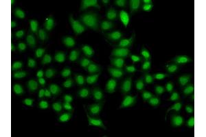 Immunofluorescence analysis of A549 cell using SULT2B1 antibody. (SULT2B1 anticorps)