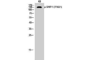 Western Blotting (WB) image for anti-Inositol Polyphosphate-5-Phosphatase, 145kDa (INPP5D) (pTyr1021) antibody (ABIN3182231) (INPP5D anticorps  (pTyr1021))
