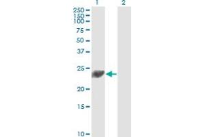 Western Blot analysis of PSMD10 expression in transfected 293T cell line by PSMD10 monoclonal antibody (M01), clone 4B5.