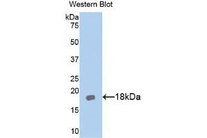Western blot analysis of the recombinant protein. (IL18RAP anticorps  (AA 396-548))