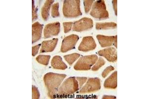 Immunohistochemistry (IHC) image for anti-Enoyl-CoA Delta Isomerase 2 (PECI) antibody (ABIN3003871)