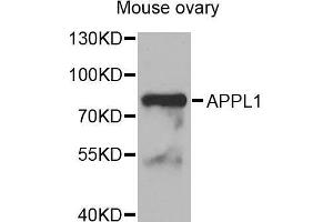 Western Blotting (WB) image for anti-Adaptor Protein, phosphotyrosine Interaction, PH Domain and Leucine Zipper Containing 1 (APPL1) (AA 1-210) antibody (ABIN1678717)