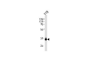 OTX2 Antibody (C-term) (ABIN1881611 and ABIN2845106) western blot analysis in Y79 cell line lysates (35 μg/lane). (OTX2 anticorps  (C-Term))