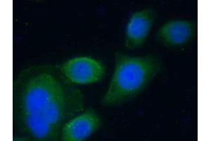 Detection of SERPINA10 in Human HepG2 Cells using Polyclonal Antibody to Serpin A10 (SERPINA10)