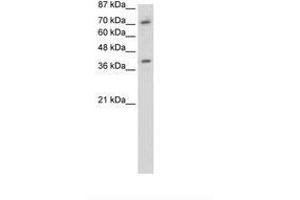 Image no. 1 for anti-Zinc Finger Protein 282 (ZNF282) (C-Term) antibody (ABIN202865) (ZNF282 anticorps  (C-Term))