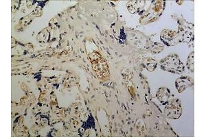 Immunohistochemistry (IHC) image for anti-Killer Cell Lectin-Like Receptor Subfamily K, Member 1 (KLRK1) (AA 78-216) antibody (ABIN1983374)