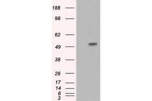 Western Blotting (WB) image for anti-Intraflagellar Transport 57 Homolog (IFT57) antibody (ABIN1498811) (IFT57 anticorps)