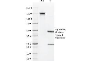 SDS-PAGE Analysis Purified CD1a Mouse Monoclonal Antibody (O10). (CD1a anticorps)