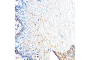 Immunohistochemistry of paraffin-embedded human esophageal using S100 Rabbit mAb (ABIN7270122) at dilution of 1:100 (40x lens).