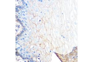 Immunohistochemistry of paraffin-embedded human esophageal using S100 Rabbit mAb (ABIN7270122) at dilution of 1:100 (40x lens). (S100A10 anticorps)