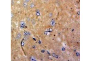 Used in DAB staining on fromalin fixed paraffin-embedded Brain tissue (M-CSF/CSF1 anticorps  (AA 33-204))