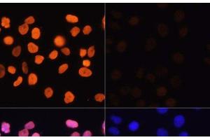 Immunofluorescence analysis of HeLa cells using Acetyl-Histone H3-K4 Polyclonal Antibody at dilution of 1:100. (Histone 3 anticorps  (acLys4))
