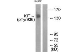 Western blot analysis of extracts from HepG2 cells treated with EGF 200ng/ml 30', using KIT (Phospho-Tyr936) Antibody. (KIT anticorps  (pTyr936))