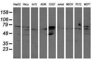 Image no. 2 for anti-Aldehyde Dehydrogenase 3 Family, Member A2 (ALDH3A2) antibody (ABIN1496594)