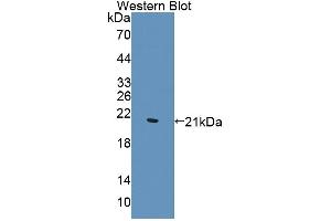 Western blot analysis of the recombinant protein. (WTAP anticorps  (AA 1-150))