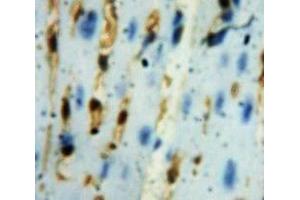Used in DAB staining on fromalin fixed paraffin-embedded Heart tissue (GLRX3 anticorps  (AA 10-117))