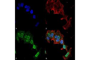 Immunocytochemistry/Immunofluorescence analysis using Mouse Anti-mGluR1/5 Monoclonal Antibody, Clone S75-33 (ABIN1027721).