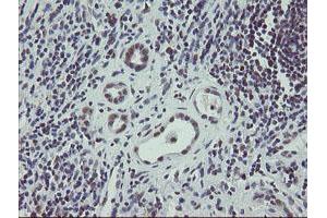 Image no. 3 for anti-Zinc Finger, BED-Type Containing 1 (ZBED1) antibody (ABIN1501794)