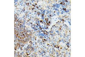 Immunohistochemistry of paraffin-embedded rat spleen using CYLD Rabbit pAb (ABIN1679467, ABIN3018138, ABIN3018139 and ABIN6220378) at dilution of 1:100 (40x lens).