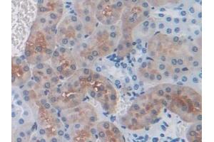 Detection of THBS1 in Mouse Kidney Tissue using Polyclonal Antibody to Thrombospondin 1 (THBS1)