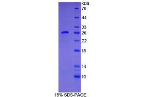 SDS-PAGE analysis of Human BCL2 Protein. (Bcl-2 Protéine)
