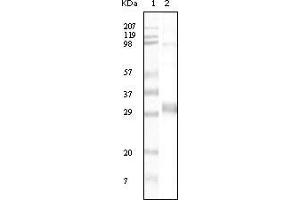 Western blot analysis using NPT mouse mAb against truncated NPT recombinant protein. (NPT anticorps)