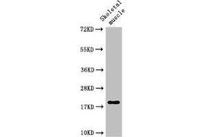Western Blot Positive WB detected in: Rat skeletal muscle tissue All lanes: TNNC1 antibody at 3 μg/mL Secondary Goat polyclonal to rabbit IgG at 1/50000 dilution Predicted band size: 19 kDa Observed band size: 19 kDa (TNNC1 anticorps  (AA 11-149))